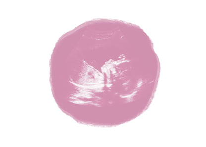 Ultrasound Baby Fine Art Print
