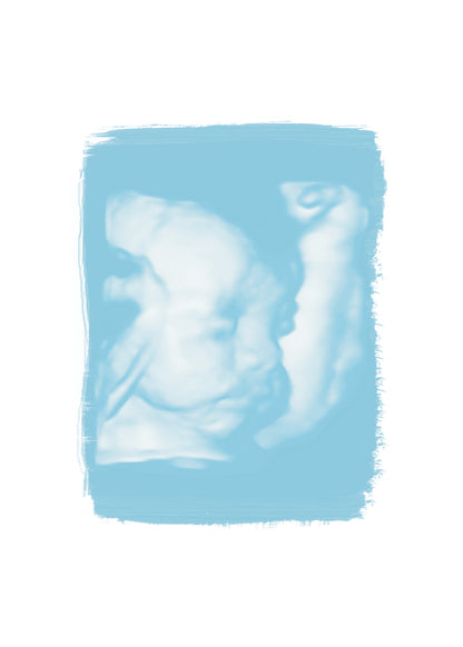 Ultrasound Baby Fine Art Print