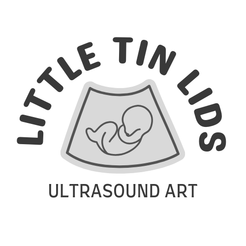 Little Tin Lids - Ultrasound Baby Art